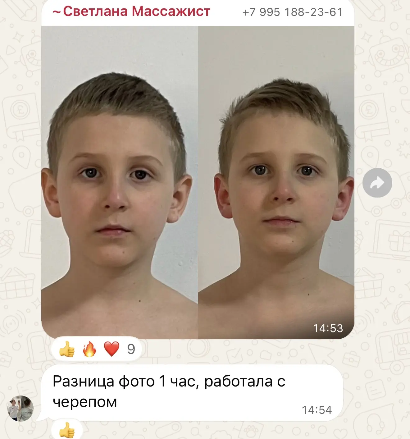 Кости черепа