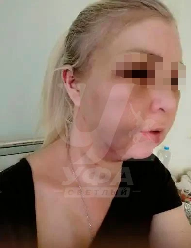 ❗️"Казалось что я просто умру": многодетную мать избили до тяжёлых травм в Черниковке