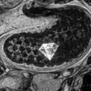 💎Мужчина украл бриллианты на 760 тысяч долларов и проглотил их, чтобы не попасться пол...