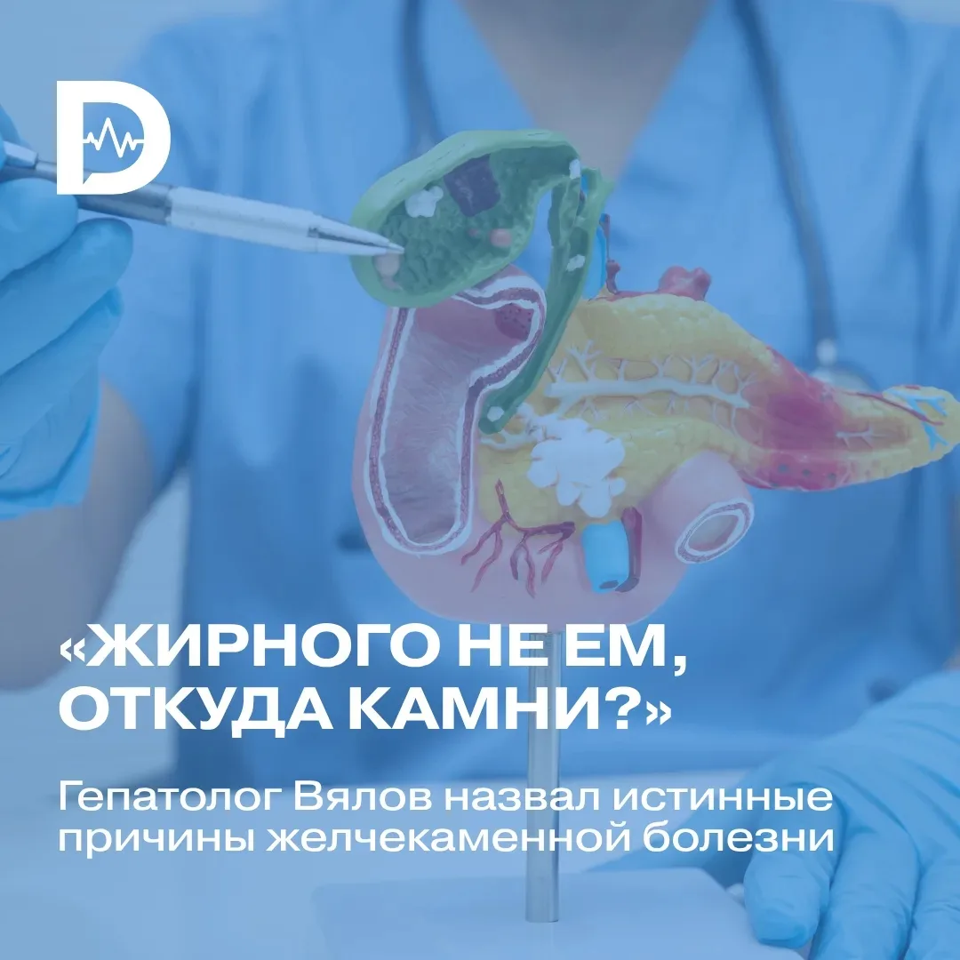 🟡 Жир — не враг! Как избежать камней в желчном пузыре?