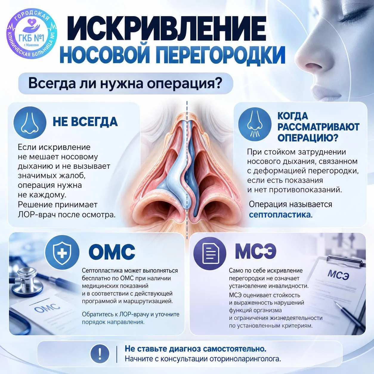 👃 Искривление носовой перегородки: всегда ли нужна операция?