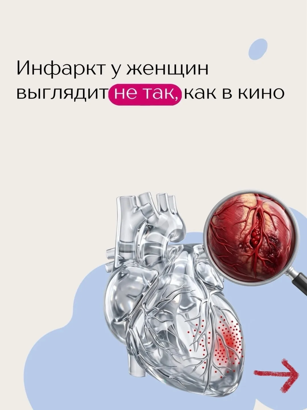 «Это просто усталость»: почему женский инфаркт прячется за маской быта