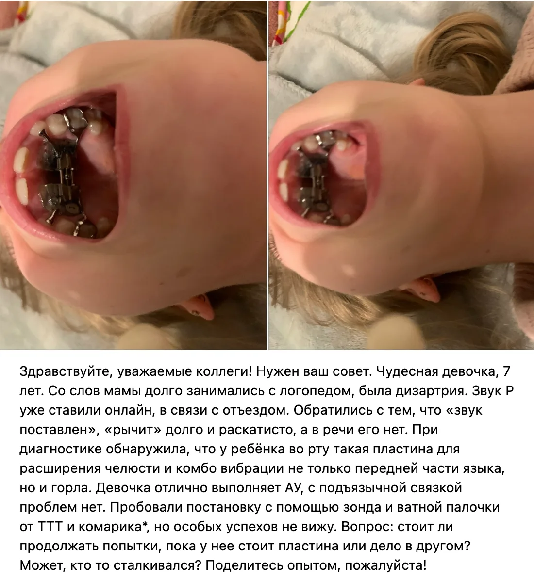 «Звук Р поставлен, рычит долго и раскатисто, а в речи его нет».