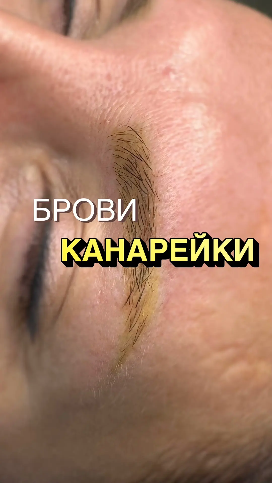Канареечный цвет сложно спрятать карандашами, он всегда фонит. А ходить без макияжа воо...