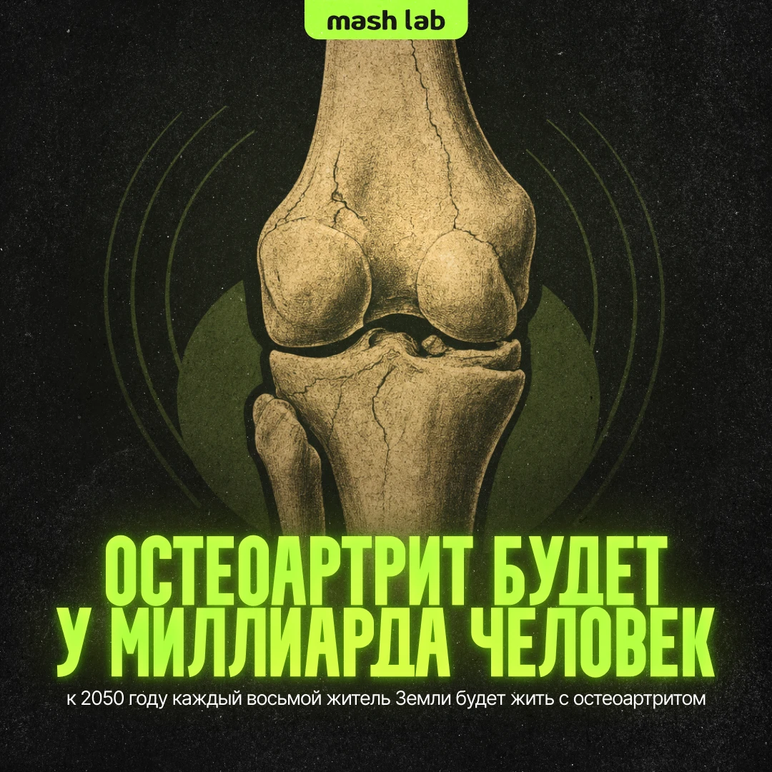 Болезнь, которая «ломает» суставы, бьет рекорды. Остеоартрит официально стал одной из г...