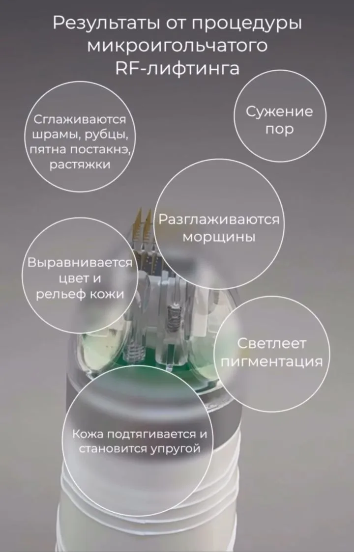 На самом деле после процедуры микроигольчатого RF результат можно увидеть уже на следую...