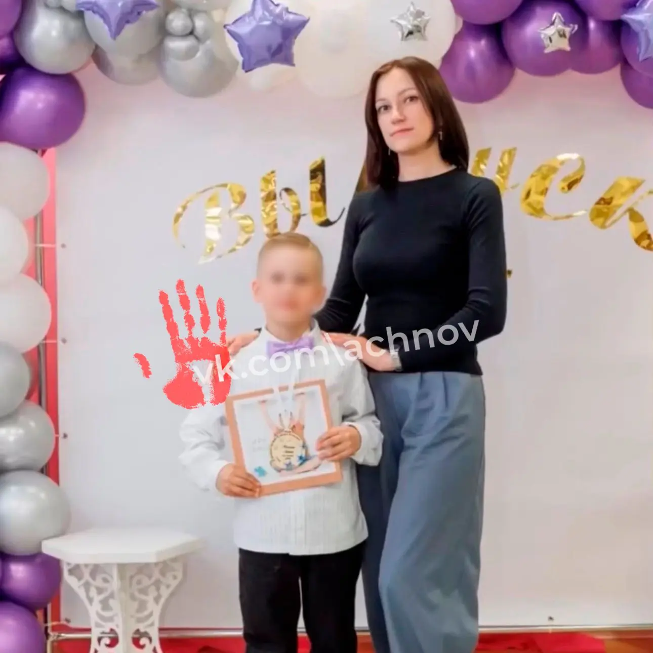 ❗️😰 «Алена уже перенесла 15 операций, а водитель пытается избежать наказания»: близкие...