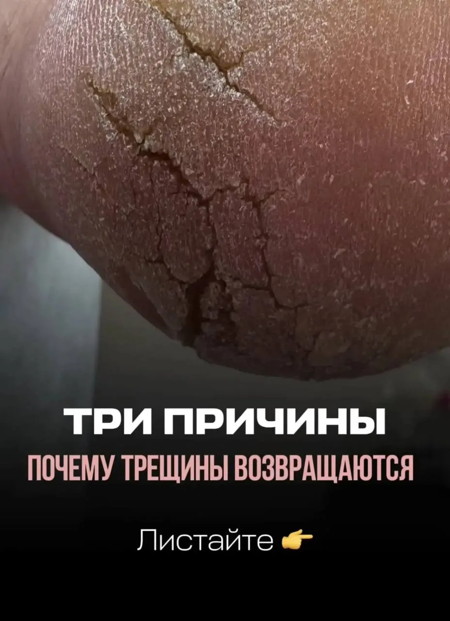 Все любят красивые фото ДО/ПОСЛЕ. И я не исключение! 😁
