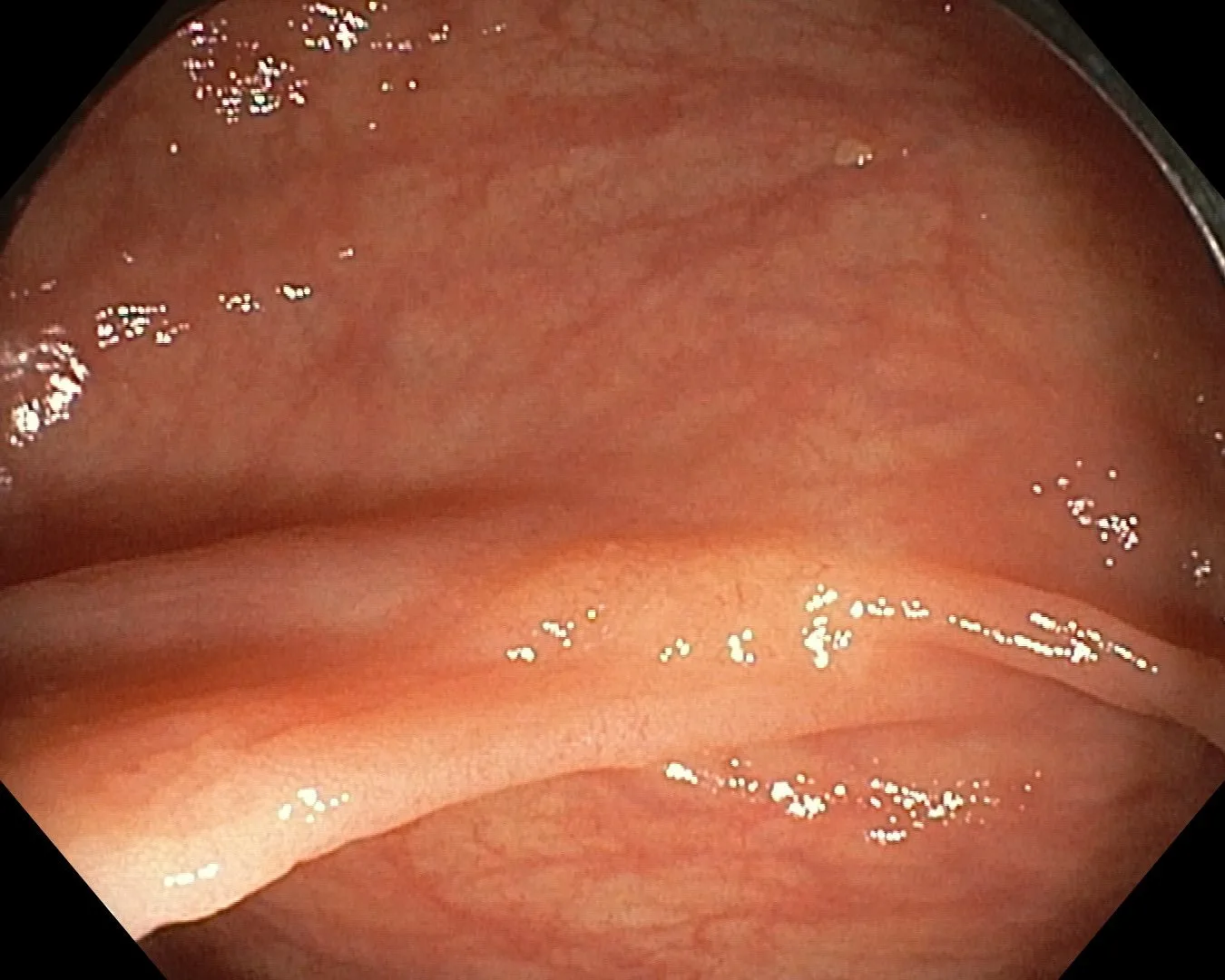 Хитрые “зубчики”😈