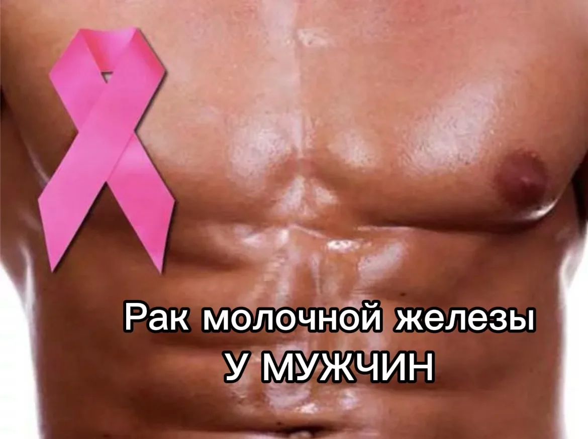 «Это бывает и у мужчин»: онколог о невидимой угрозе рака груди.