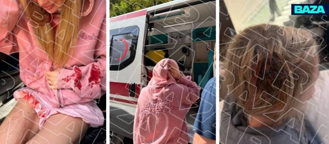 Петербурженка оказалась в эпицентре камнепада во время фотосессии со стилёвой обезьянко...