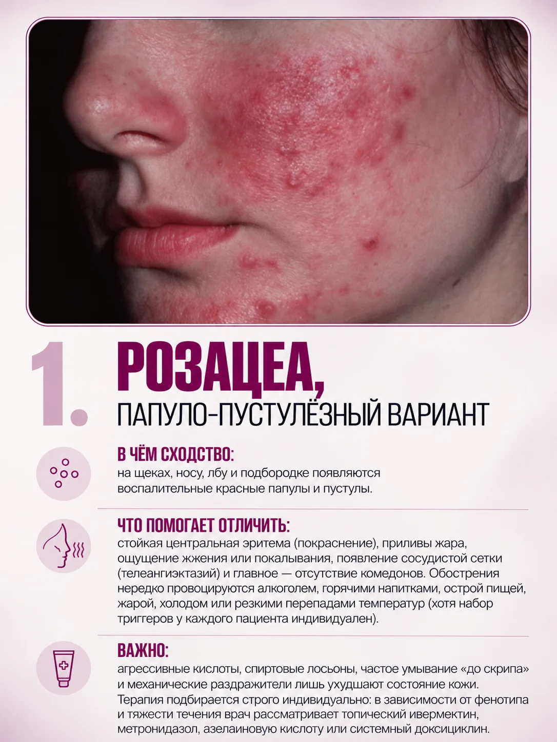 Это точно акне? 5 состояний, которые могут его имитировать