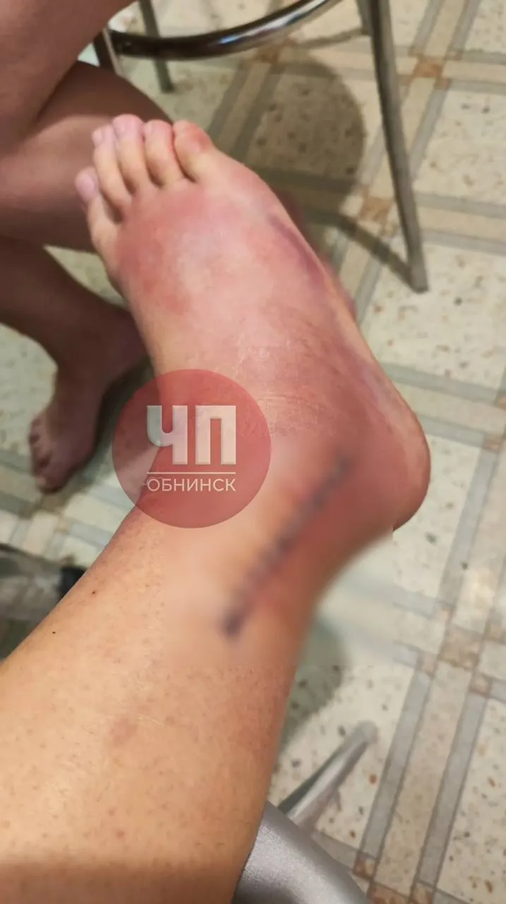 Нашему подписчику сломали ногу в баре «Бах». Спустя два года нападавший, по его словам,...