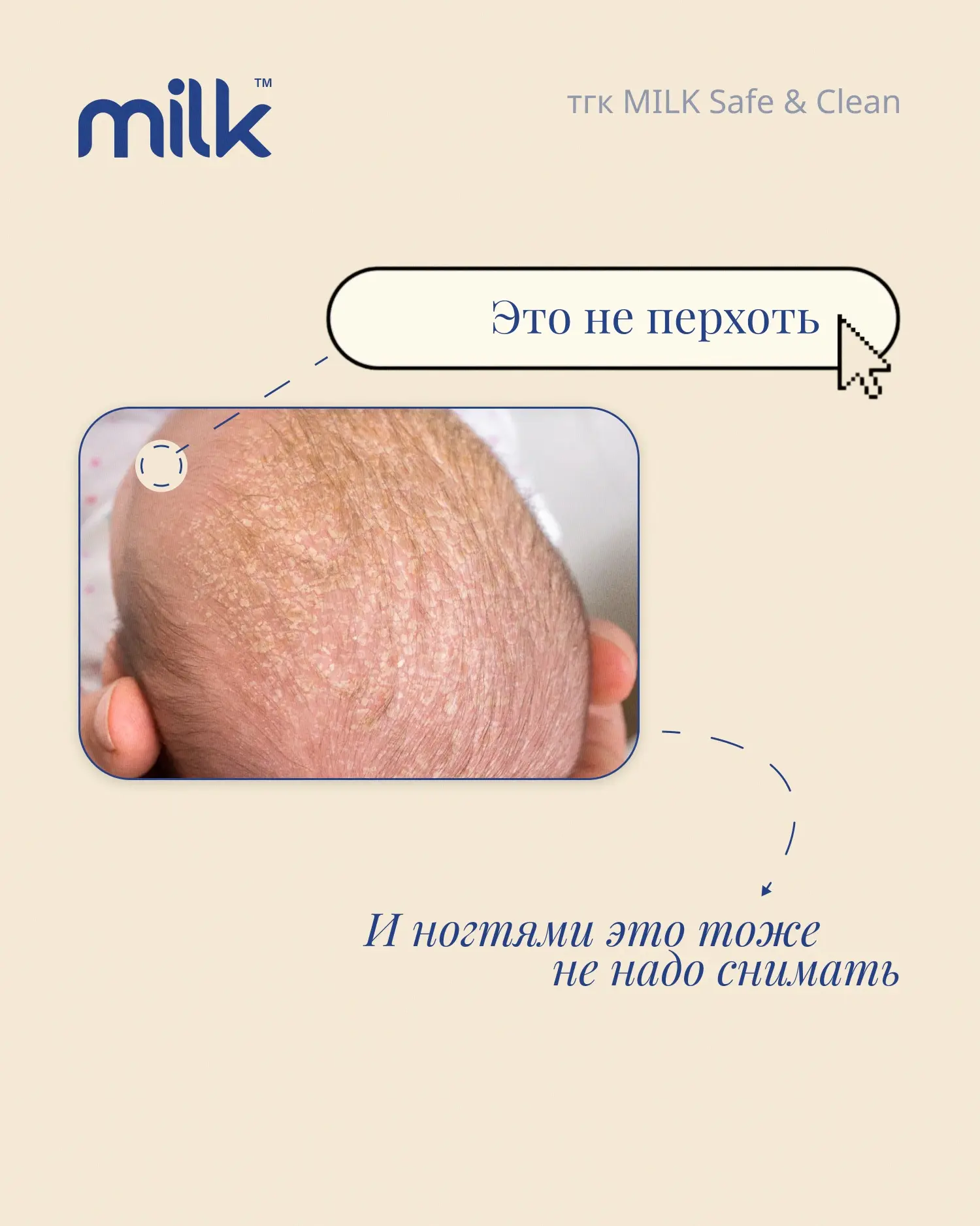 Корочки на голове новорождённого✨