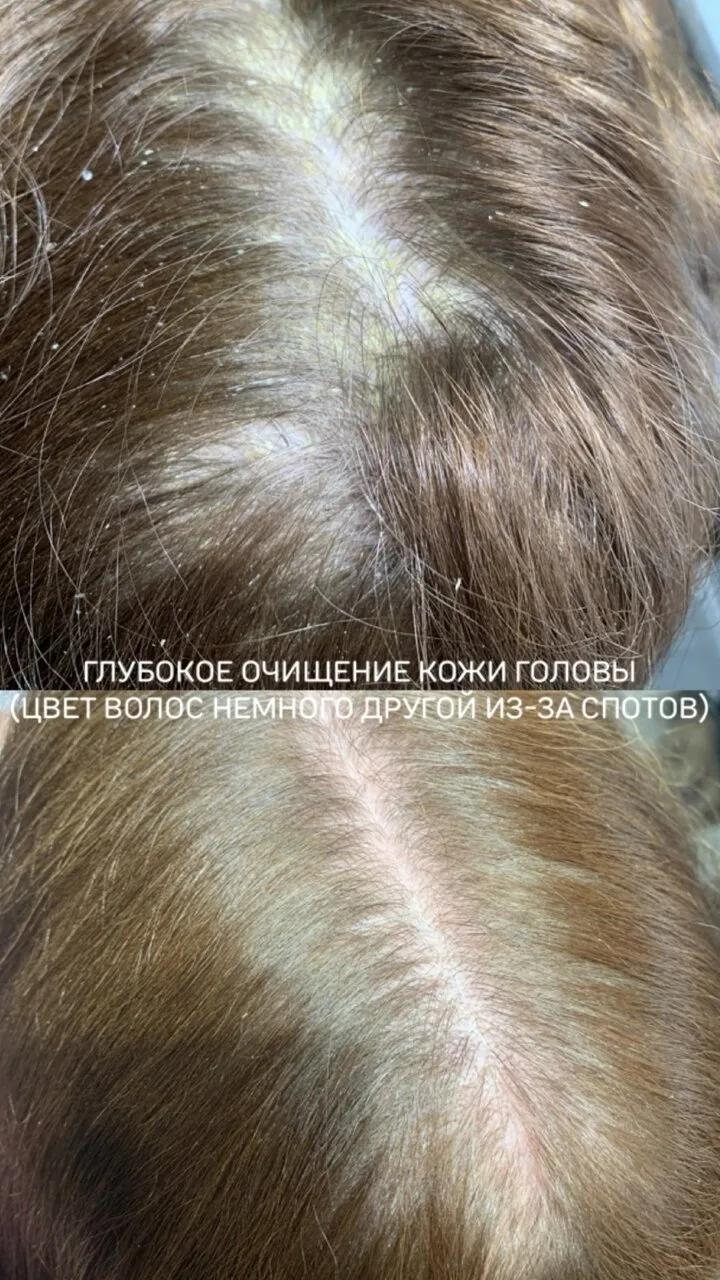🌿ТРЕБУЕТСЯ 10 МОДЕЛЕЙ НА АВТОРСКИЕ КОМПЛЕКСЫ ВОССТАНОВЛЕНИЯ ВОЛОС И КОЖИ ГОЛОВЫ🌿