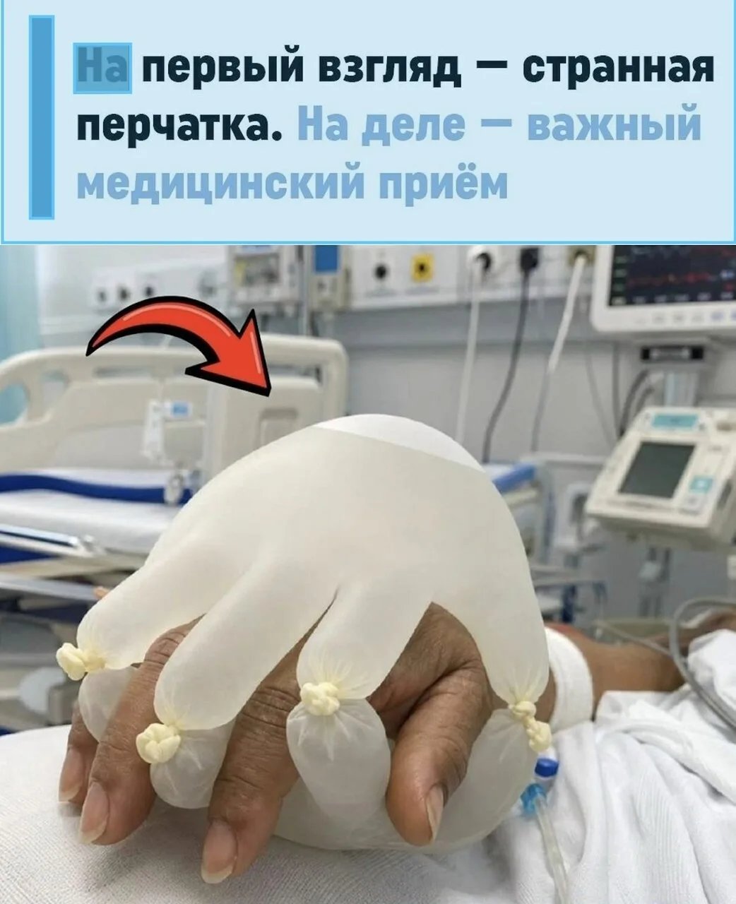 Надувную перчатку с физраствором применяют в реанимации не ради эксперимента: она помог...