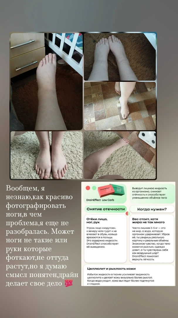 Вообщем, я незнаю,как красиво фотографировать ноги,в чем проблема,я еще не разобралась....