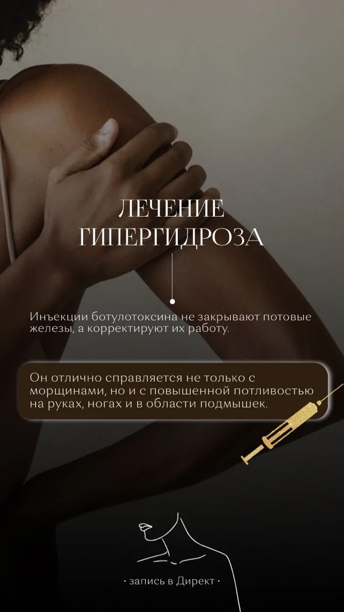 Лечение гипергидроза ботоксом (ботулотоксином типа A) является эффективным методом умен...