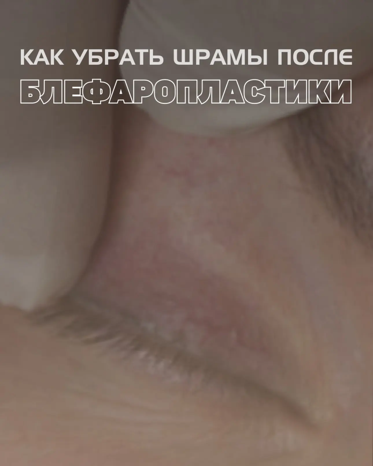 Мастер камуфляжа- ваша последняя инстанция на пути к идеальному результату. Только он м...