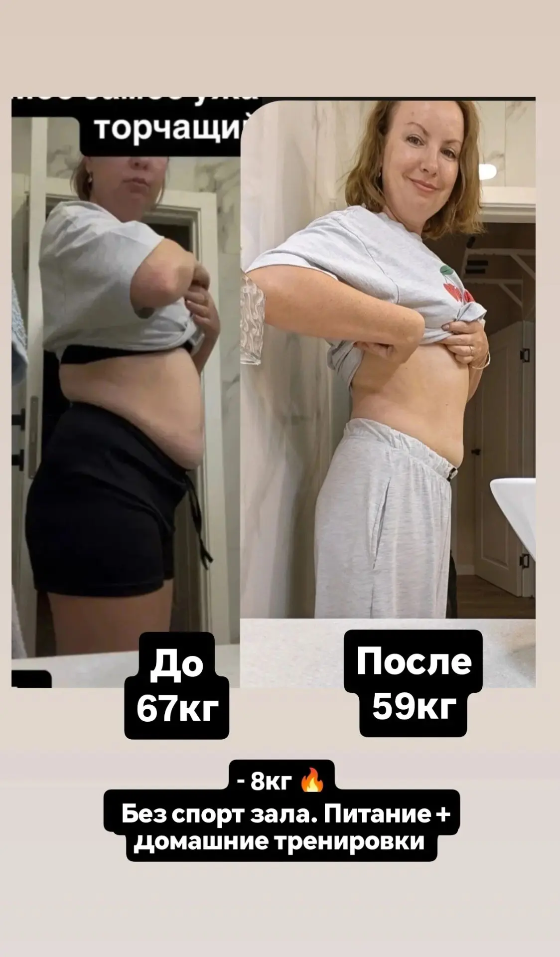Да я ходила к пластисескому хирургу🙈 но когда он сказал цену на на липосакцию (около 7...