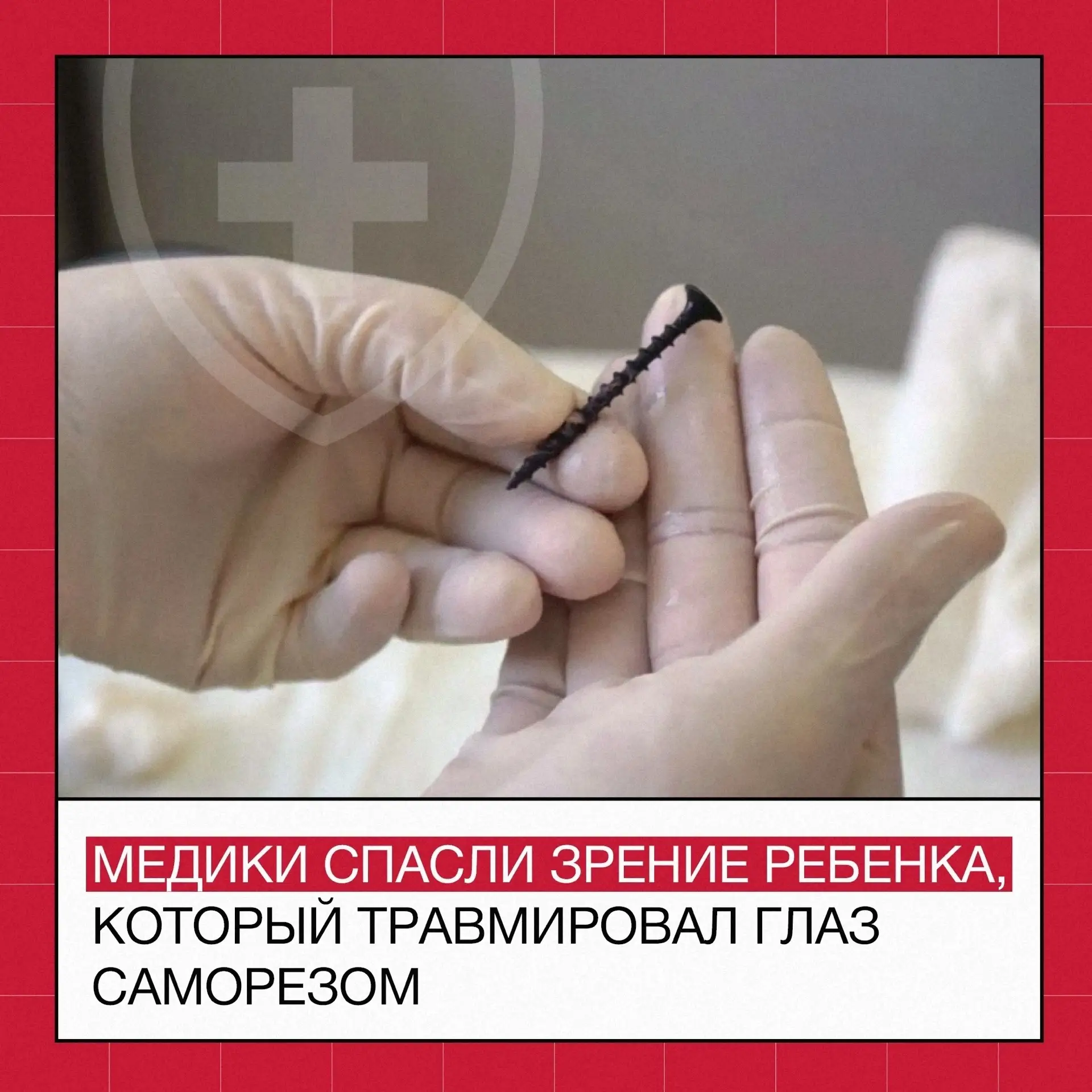 😱 Хирурги сохранили зрение малышу: саморез случайно вошел в его глазницу