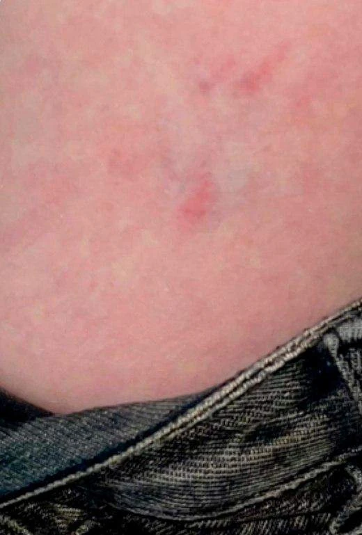 Ярославского фотографа укусила бродячая собака