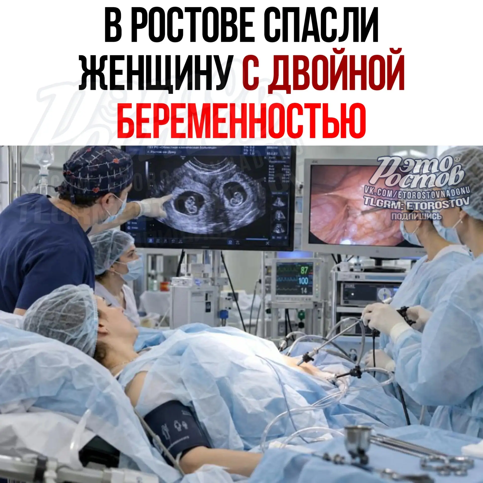 ❤️ Редкий случай: врачи спасли ростовчанку с двойной беременностью!