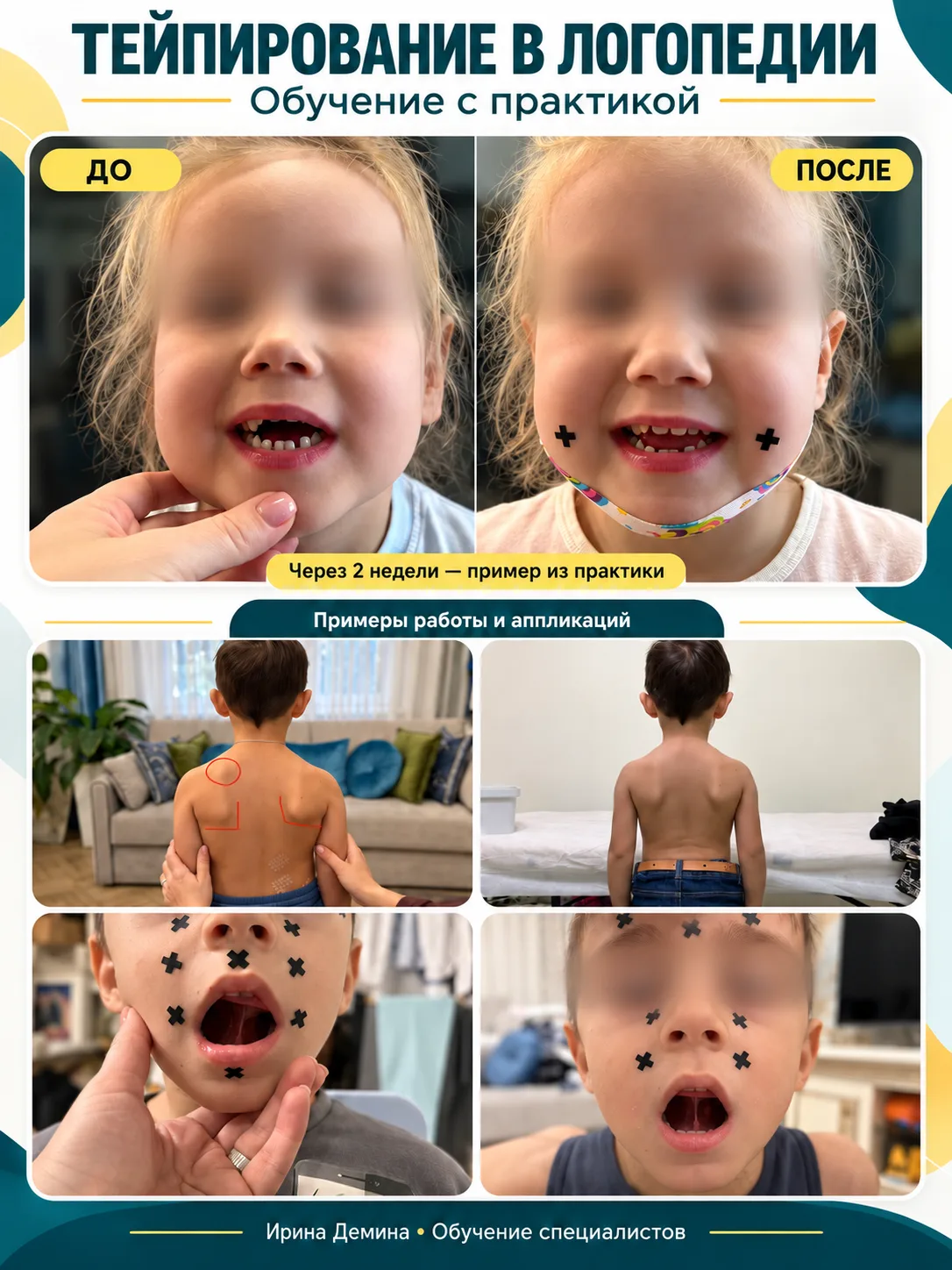 🧑‍⚕️ Коллеги осваивают тейпирование целыми командами. Что привлекает специалистов?