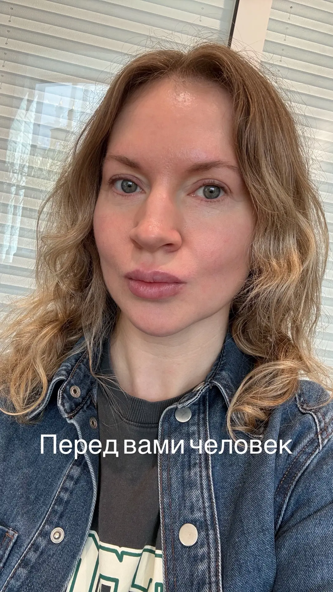 «Обожаю» этих врачей - губы после приема, будто миллилитр филлера залили😂