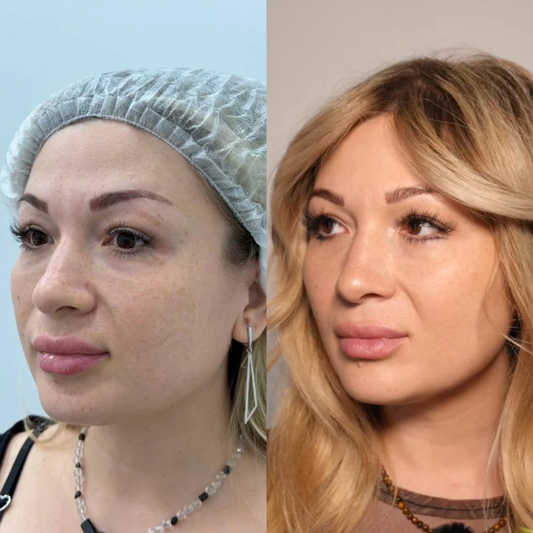 Комплекс процедур "до и после"