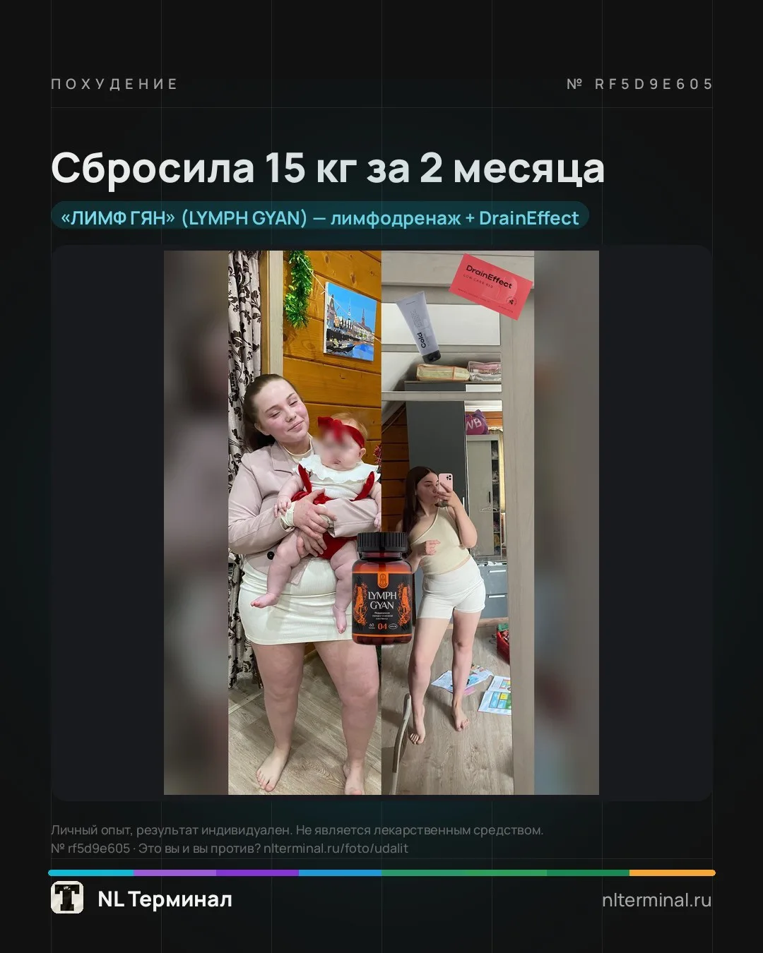 Лимф гян у кого проблемы с отеками