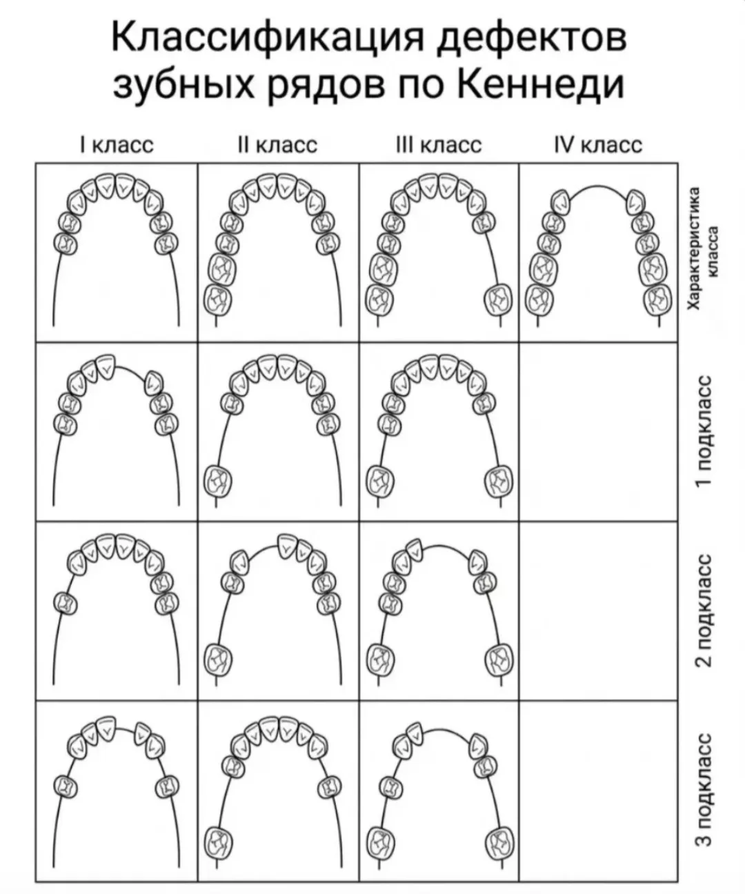🦷 Классификация дефектов зубных рядов по Кеннеди