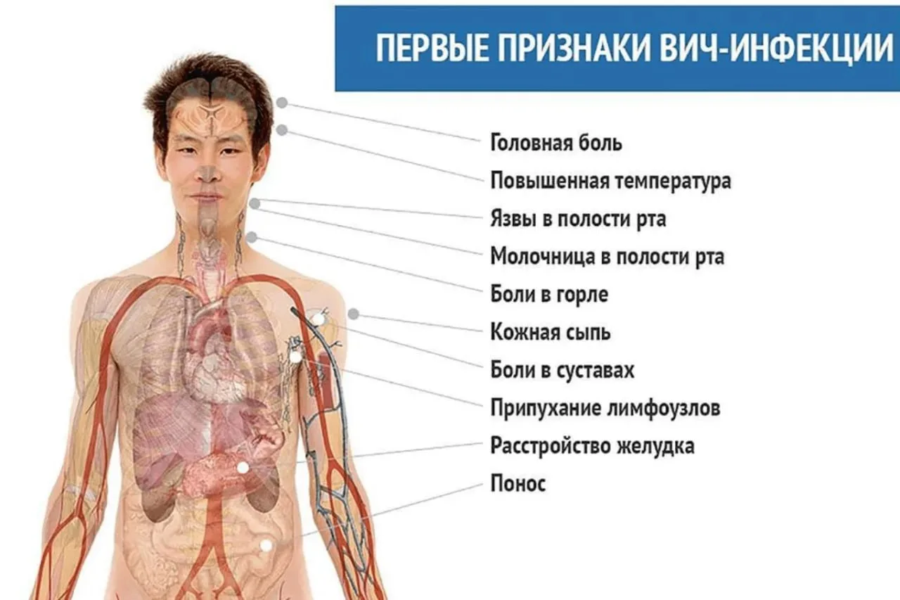 Как получить группу инвалидности при ВИЧ‑инфекции 🩺