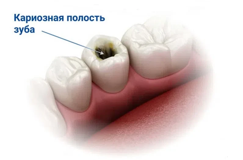 🦷Всемирный день за будущее без кариеса отмечается