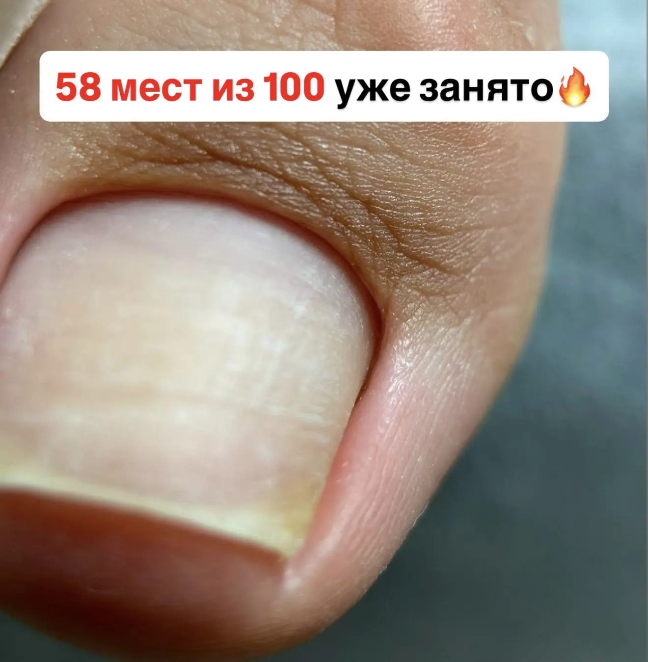 На тарифе «Эстетика с элементами подологии» уже 58 учениц🔥