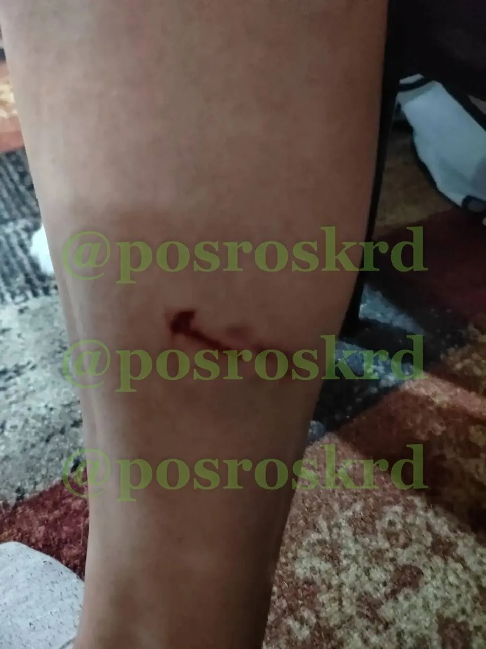 В продолжении недавнего поста об агрессивных собаках