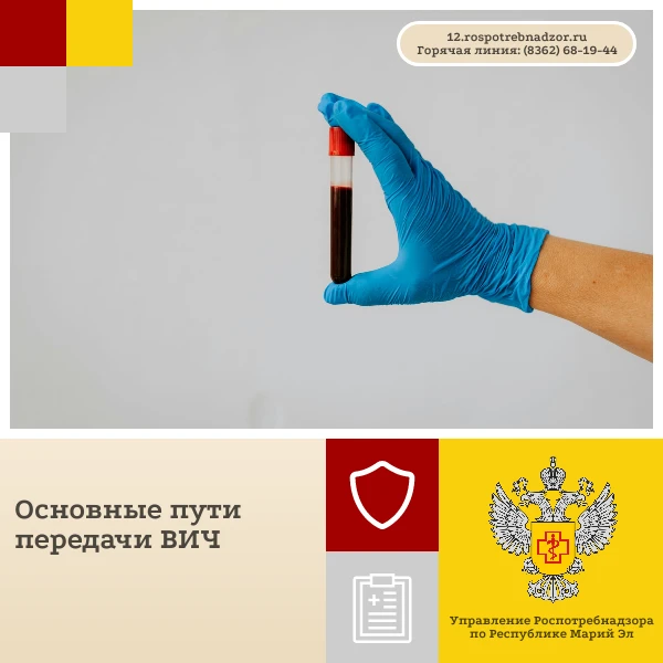 Основные пути передачи ВИЧ-инфекции связаны с контактом с биологическими жидкостями инф...