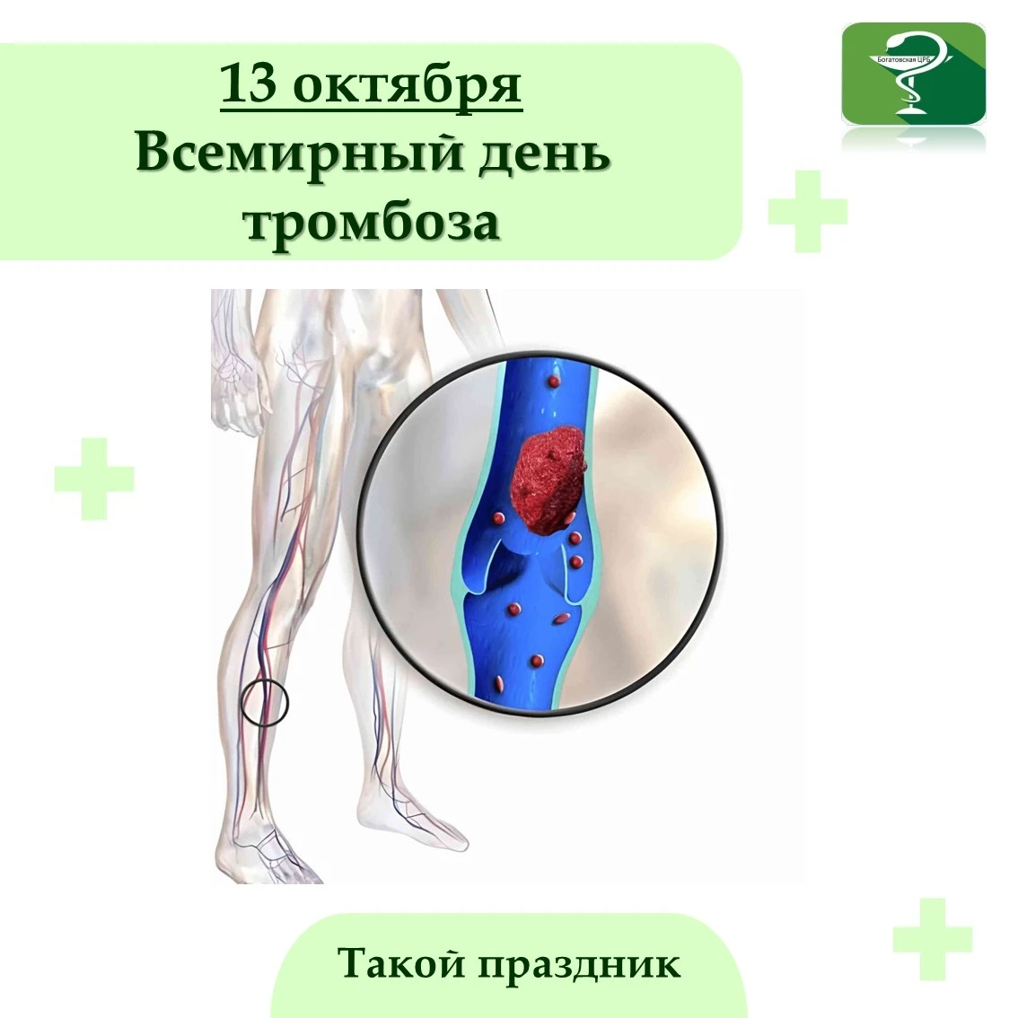 13 октября отмечается Всемирный день тромбоза. В этот день медики всего мира обращают в...
