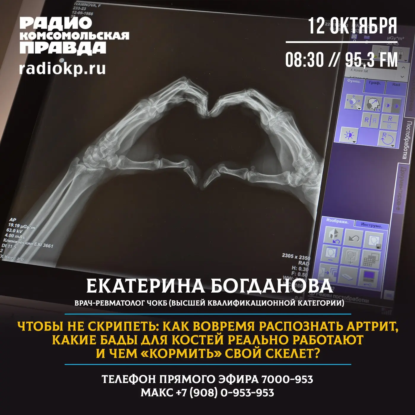 💊 12 октября - Всемирный день борьбы с артритом. У этого заболевания множество обличий...