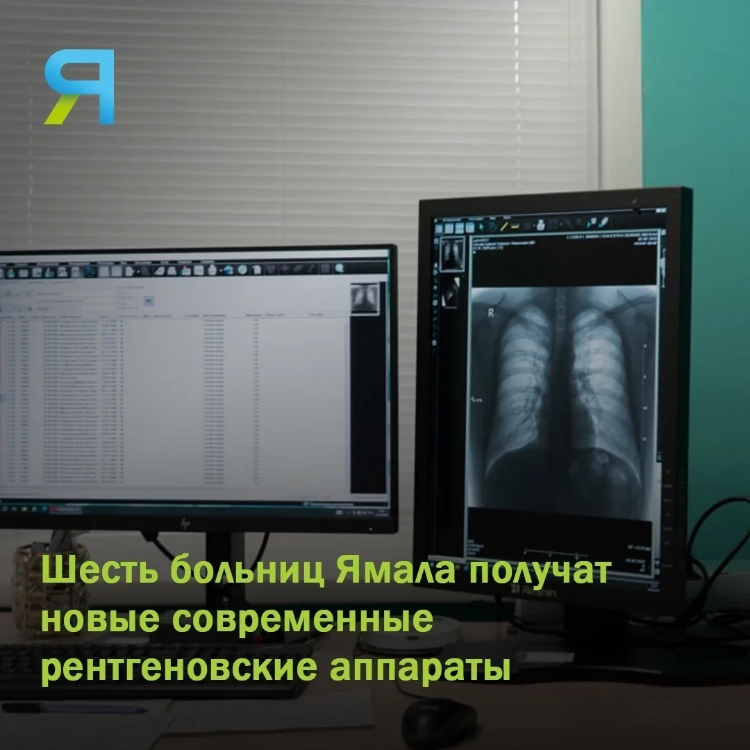 🏥 В больницы Ямала доставят переносные рентгеновские устройства