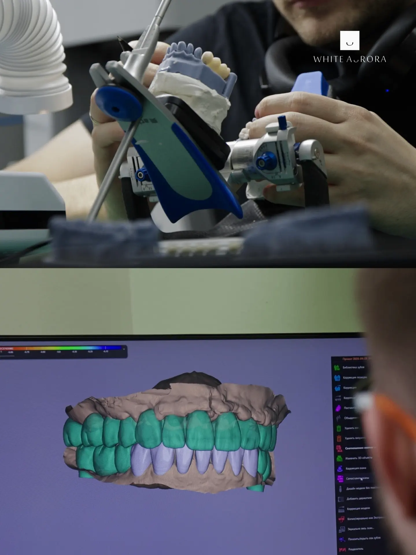 🦷Собственная зуботехническая лаборатория White Aurora — преимущество пациента