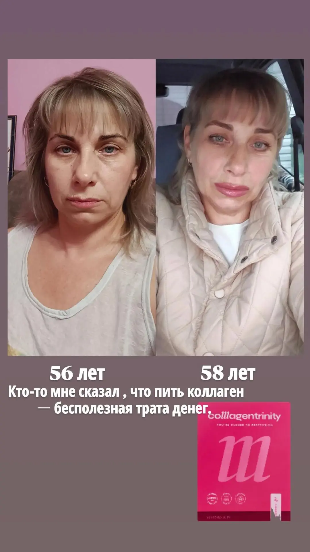 Прошёл год, как пью коллаген