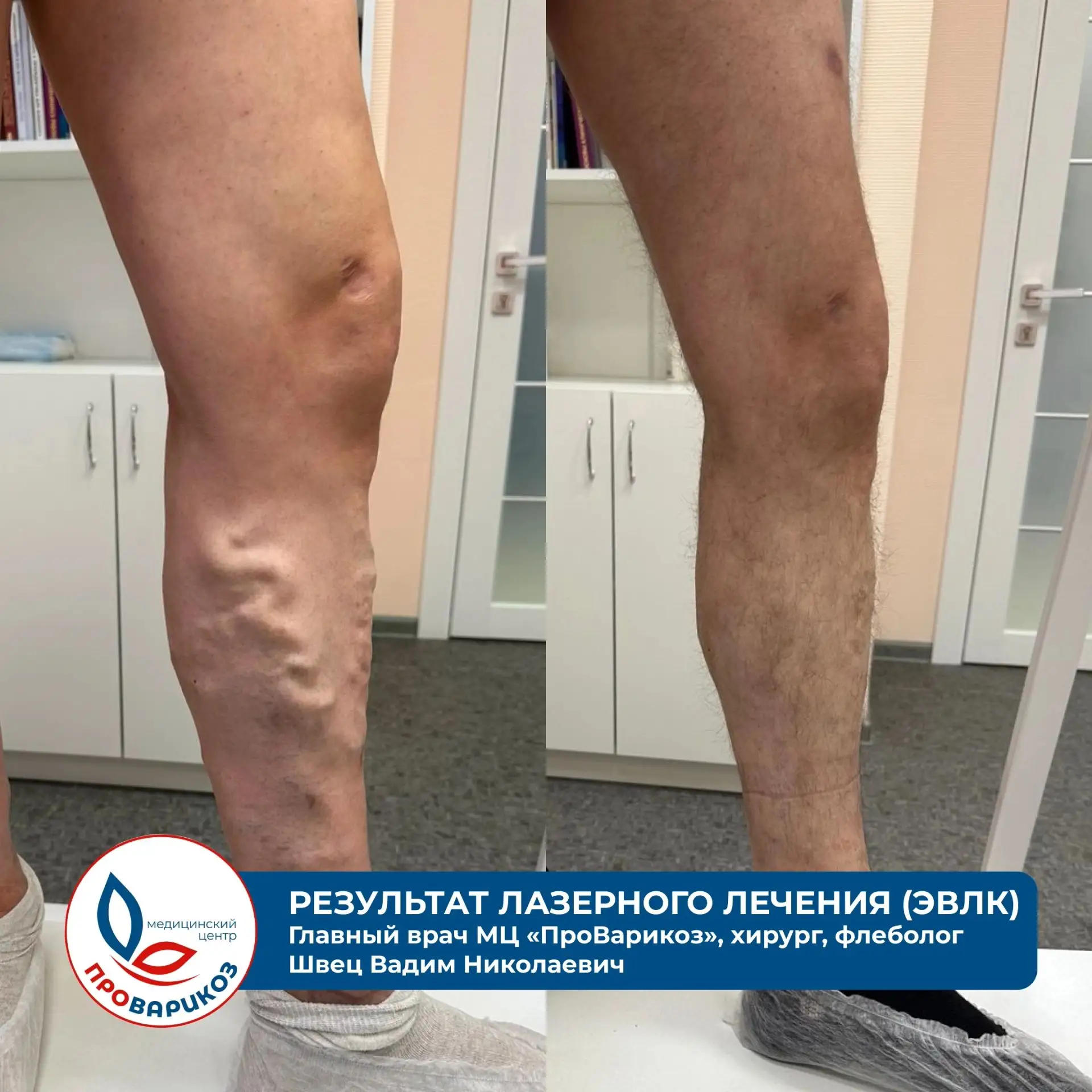 Запишитесь к флебологу, не выезжая из своего города