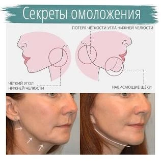 📐 «Углы Джоли»: когда контурная пластика челюсти дает шик, а когда — отекшее мужское л...