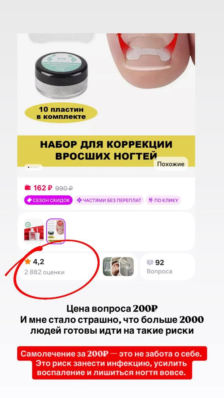 Листала вб и пришла в ужас: наборы для самостоятельной установки титановой нити за копе...