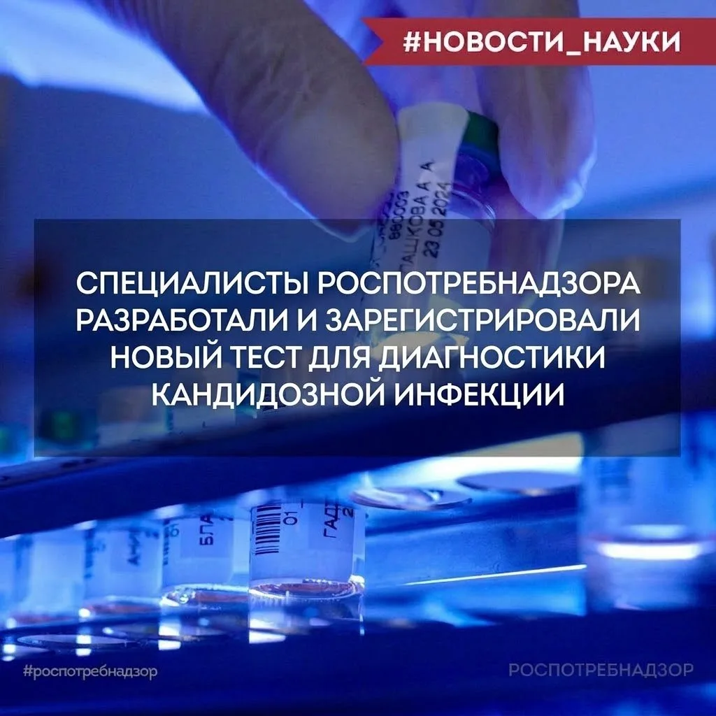 Ученые ЦНИИ Эпидемиологии Роспотребнадзора разработали новый тест для количественного о...