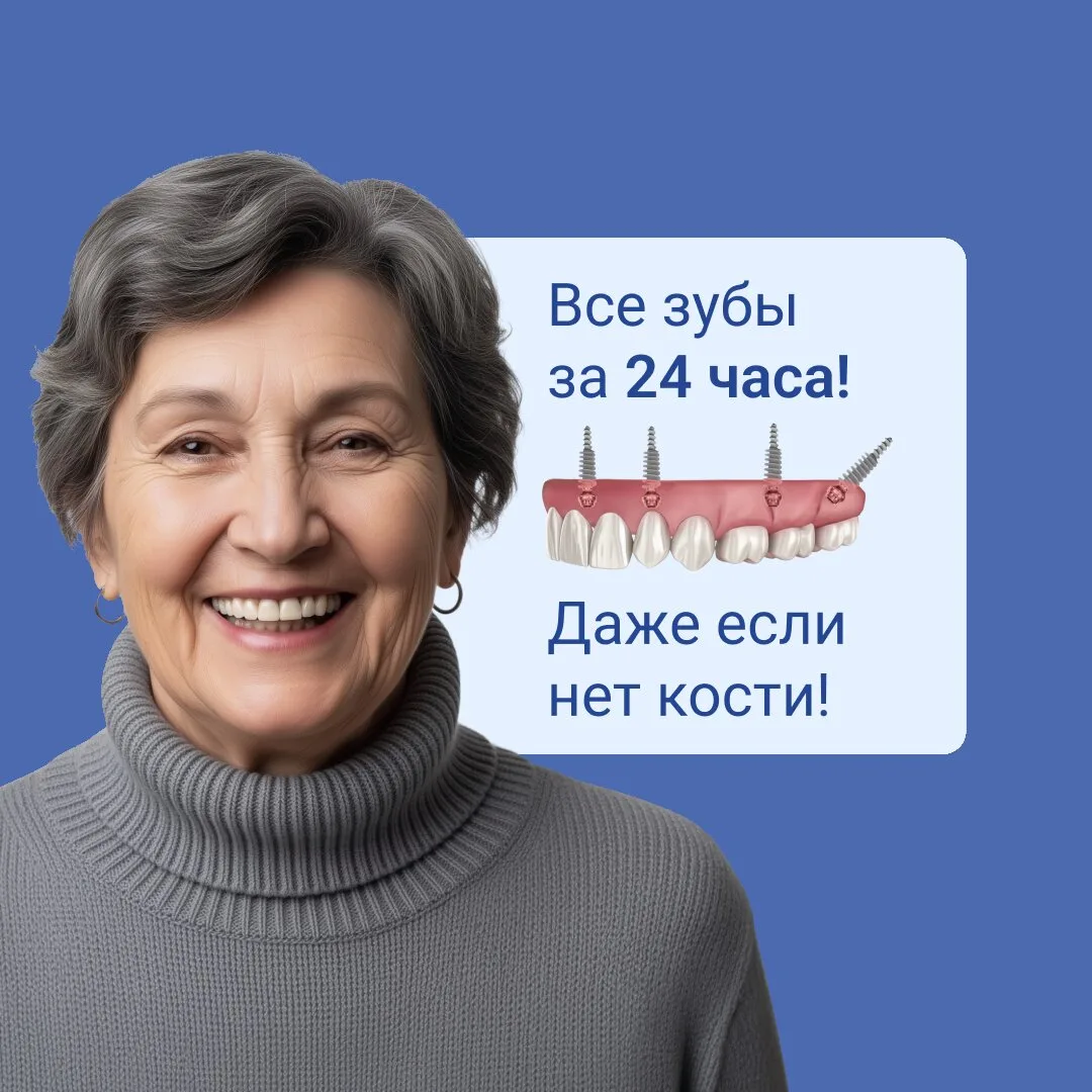 Бережная имплантация всех зубов за 1 день в Самаре!