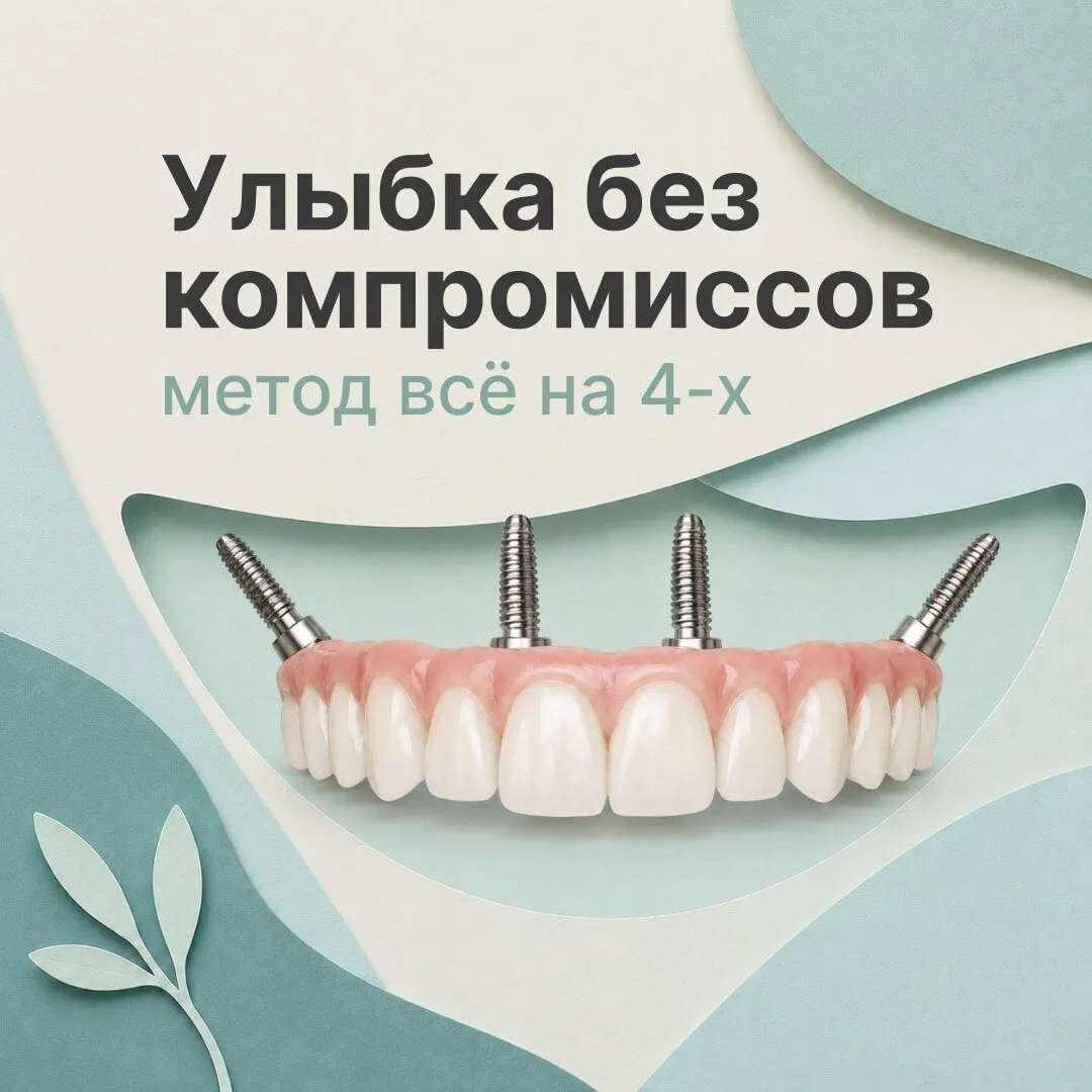 «Эстет»: новые зубы на 4-х имплантах Osstem Implant®