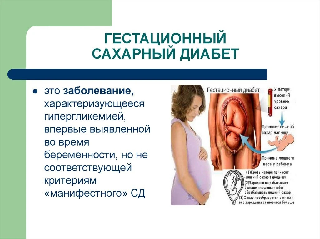 Что такое ГСД 🌝