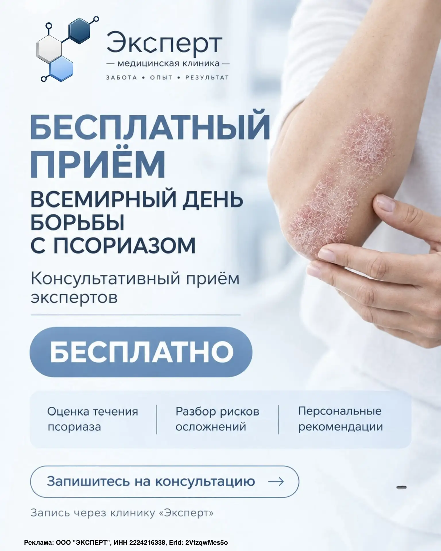 День псориаза: бесплатный консультативный приём экспертов
